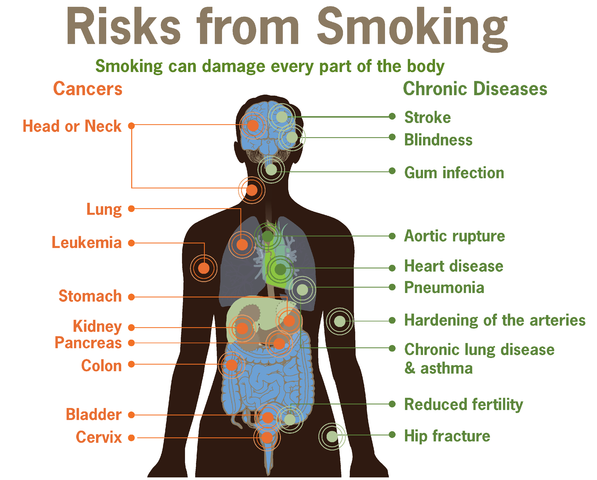 Diagram highlighting parts of the body that can be damaged by smoking.