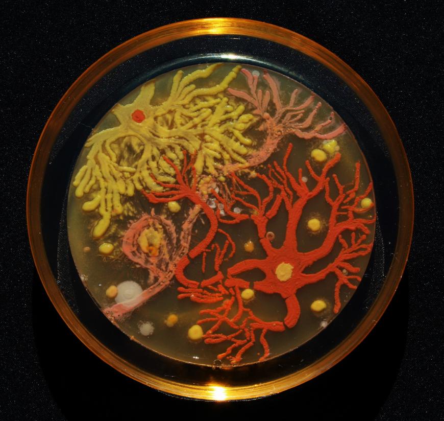 Neurons grown in agar