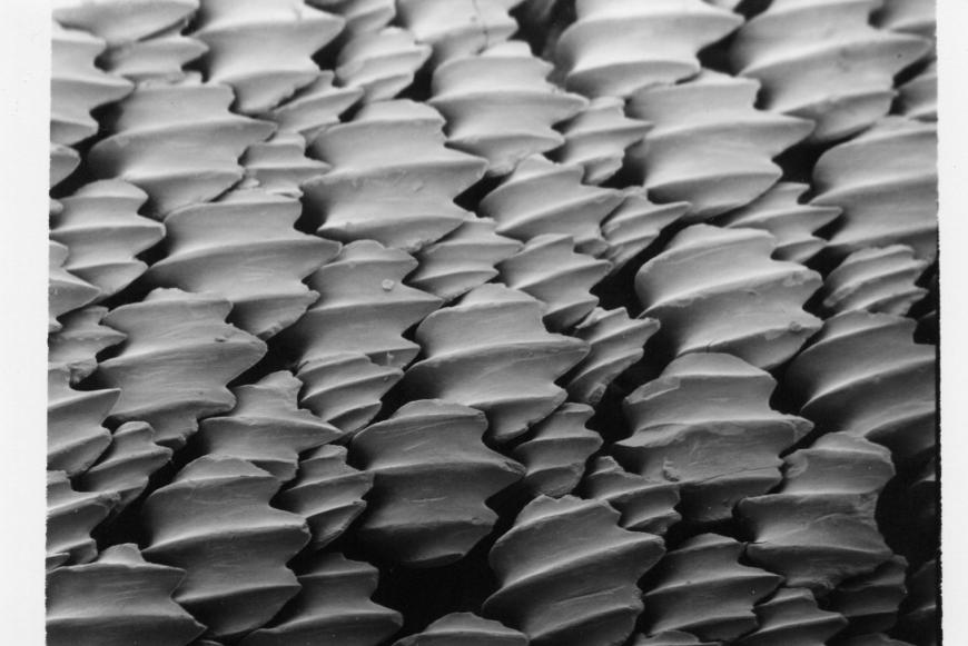 Scanning electron micrograph of shark skin
