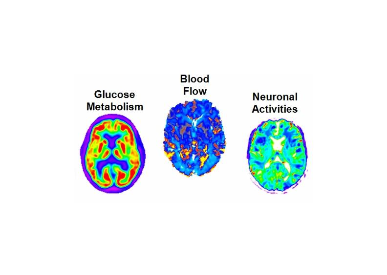 Brain scans of blood flow, glucose metabolism, and neuronal activities, used to measure amyloid concentration