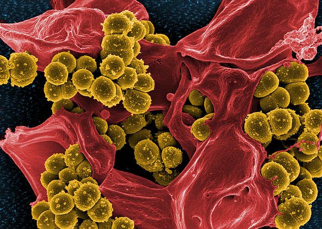 Micrograph of methicillin-resistant Staphylococcus aureus