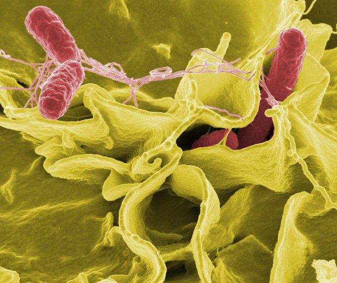 Salmonella bacteria under a scanning electron microscope. False coloring.