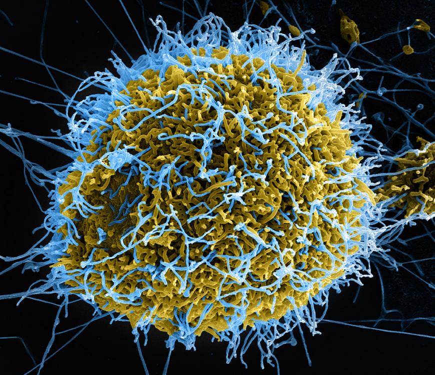 Ebola virus particles