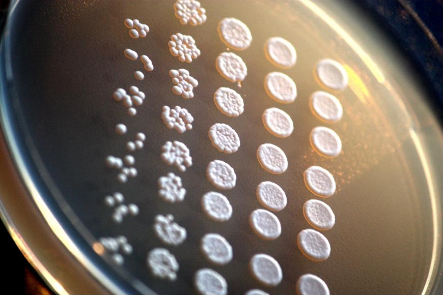 yeast colonies (Saccharomyces cerevisiae) mutants on an agar plate