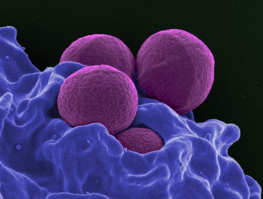 A neutrophil (white blood cell) envelopes an MRSA bacterium