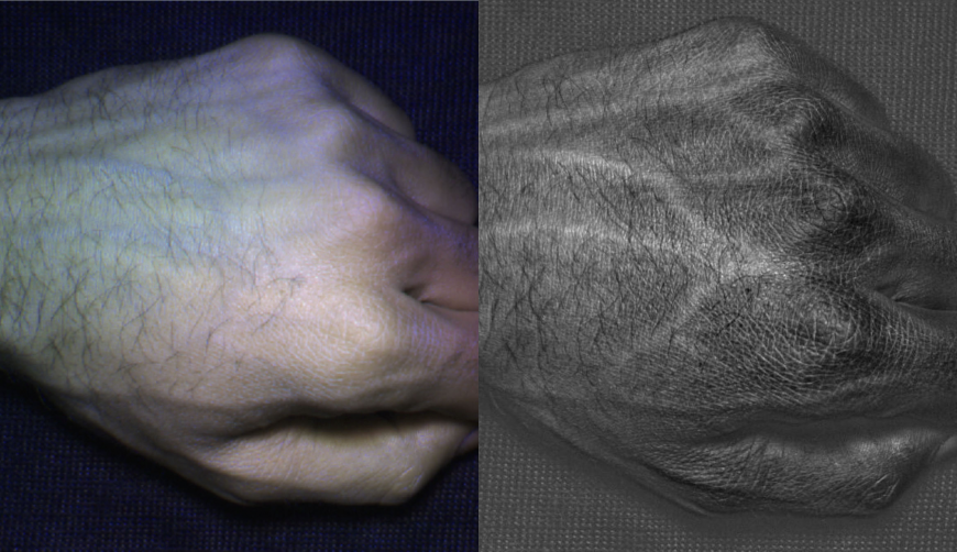 Veins in a human hand, revealed by the HyperCam