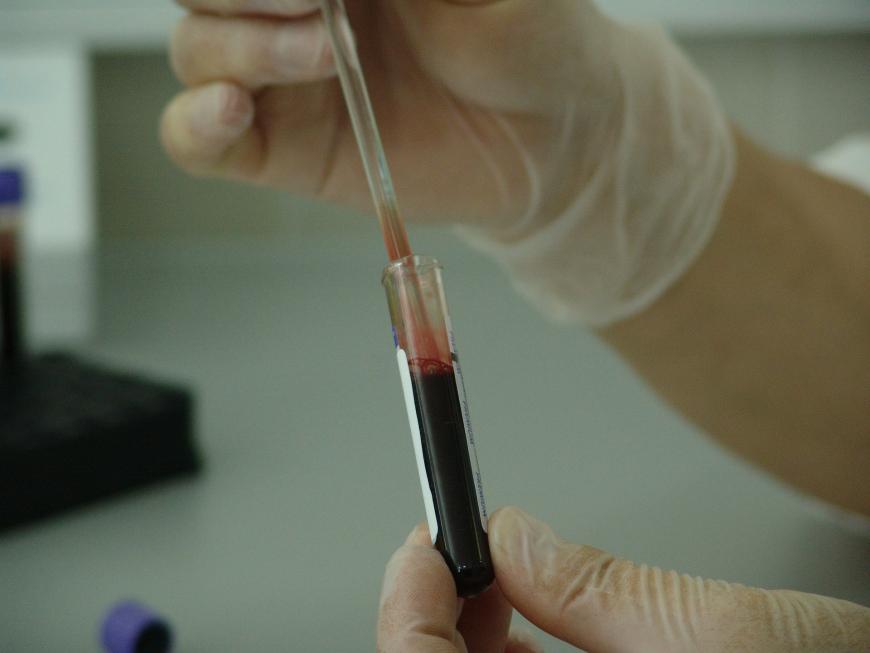 Blood analysis in a medical laboratory