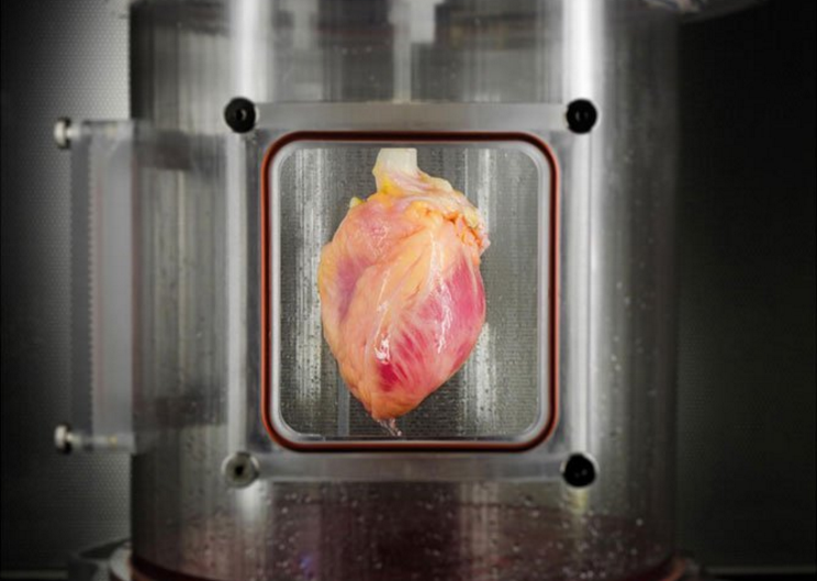 Heart grown from stem cells and a decellularized donor organ