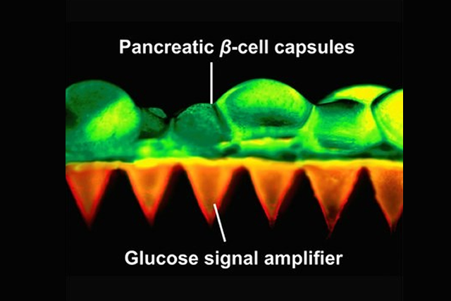 Insulin patch with microneedles