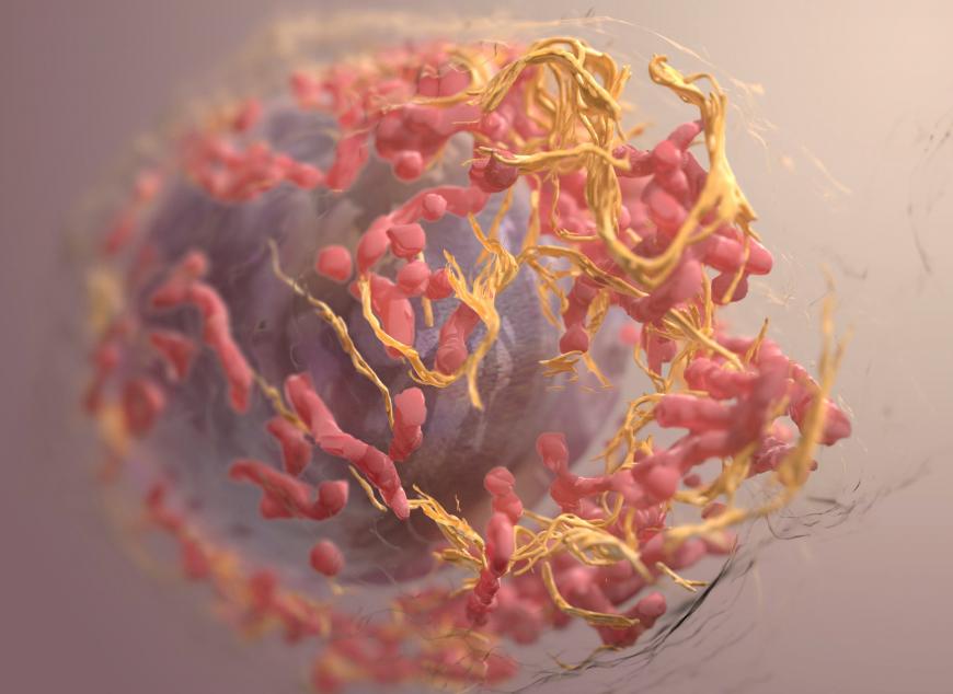 3D structure of a melanoma cell derived by ion abrasion scanning electron microscopy. 