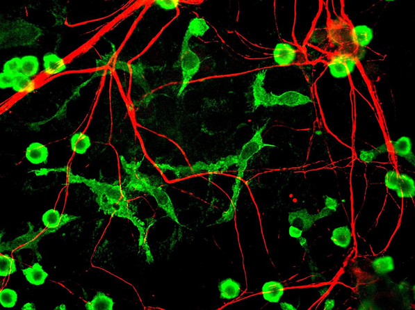 Rat brain culture, neurons coloured red, microglia in green