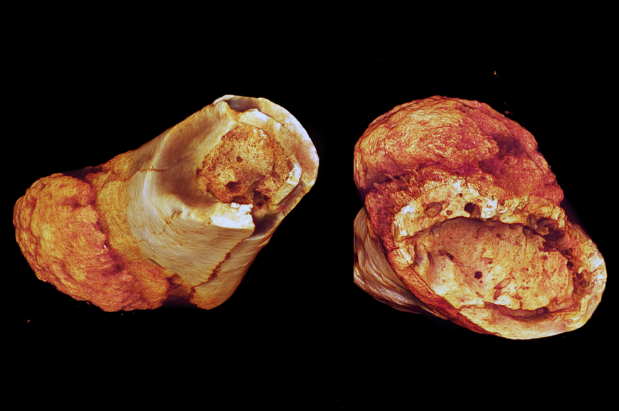 Surface-rendered models of the cancerous metatarsal fossil