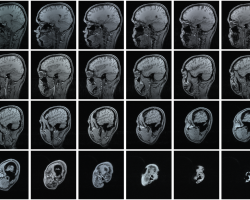 Results of an MRI scan. 24 thin sections of the human head