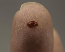 Blood test, finger prick