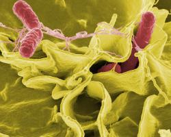 Micrography of Salmonella bacteria