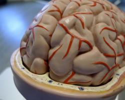 Plastic model of a brain