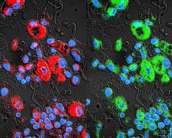 Drug-resistant lung cancer cells are in red. Paclitaxel-loaded exosomes (green) swarm the cancer cells and bypass their drug resistance.