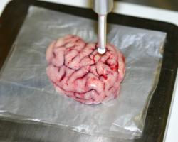 Intelligent scalpel identifies tumors in a pig&#039;s brain