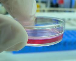 Cell culture in a petri dish