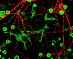 Microscope image of neurons and microglial cells