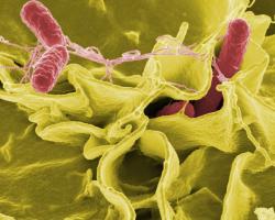 Salmonella bacteria under a scanning electron microscope. False coloring.
