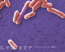 Escherichia coli bacteria seen under a scanning electron microscope