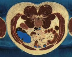 Sliced cross-section of a human body