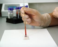 Blood analysis in a medical laboratory
