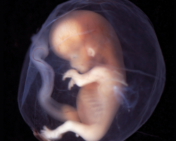 Human embryo, 9-10 weeks after conception