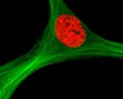 Scientists develop magnetic stem cells for gene engineering