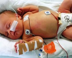 Newborn infant in a hospital bed