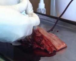 (Warning- Blood) Veti-Gel Stops Bleeding Instantly - Video - TechNewsDaily.com
