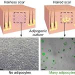 Using fat to help wounds heal without scars